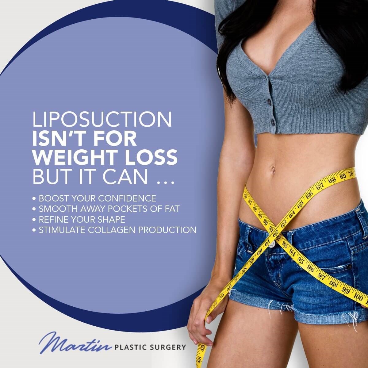 Liposuction